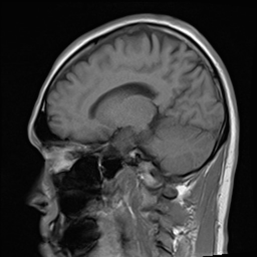 Click on the Serie image to view the images of VILLANUEVA, WILLIAM A.